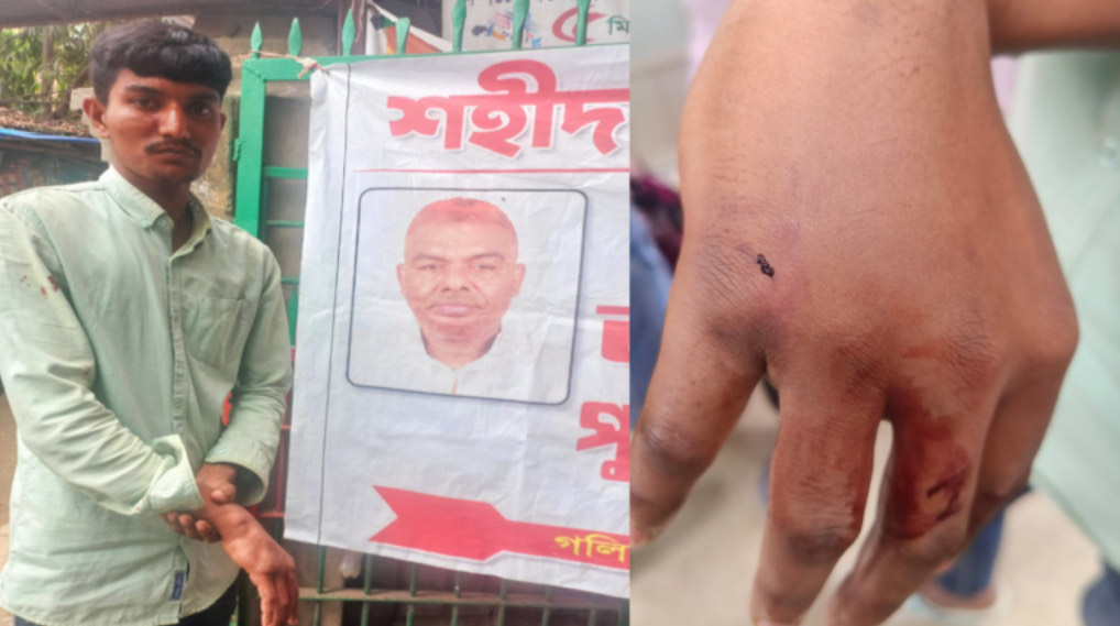 ফতুল্লায় বরিশাইল্লা শহিদ বাহিনীর হামলায় হৃদয়ের আঙ্গুলের হাড় দ্বিখন্ডিত!